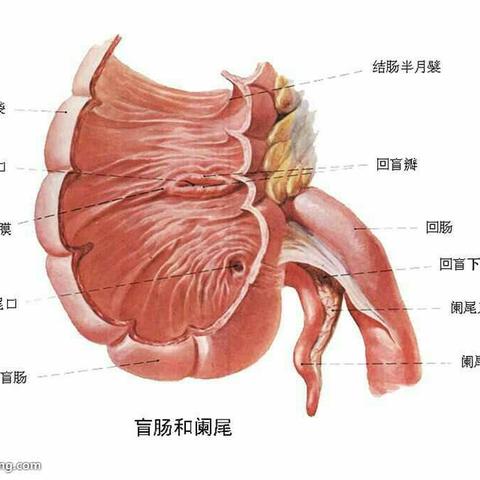 阑尾鉴别诊断之盲肠憩室