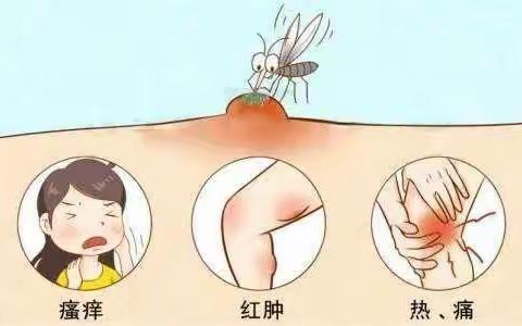 带你认识“丘疹性荨麻疹”