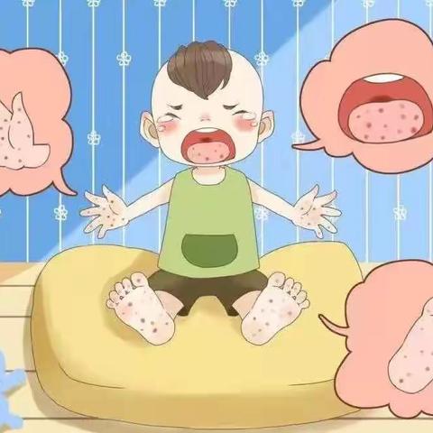 【叮叮幼儿园】疱疹性咽峡炎预防小知识宣传