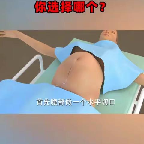 剖腹产、和顺产