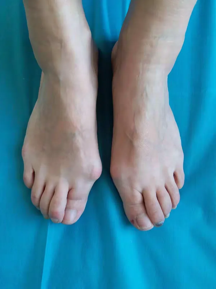 削足适履
