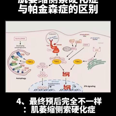 北京辰星中医：肌萎缩侧索硬化症与帕金森症的区别（四）