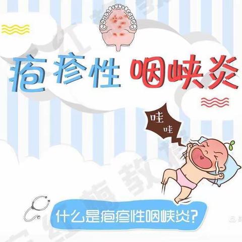 夏云镇第二幼儿园   【健康护我行】怎样预防疱疹性咽颊炎