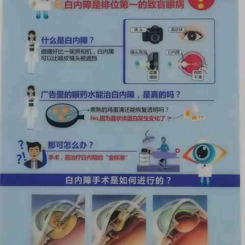 白内障手术知识注意事项点眼药流程
