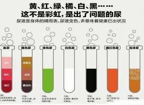 你最近一次的尿液是什么颜色的？（大同曙光男科转发）