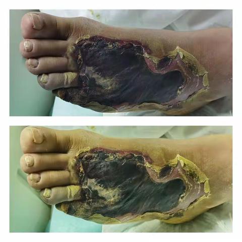 救命、救智、再救脚梗！