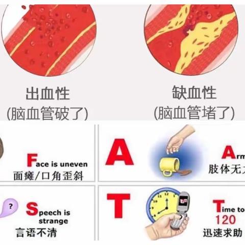 神经康复的几大误区！