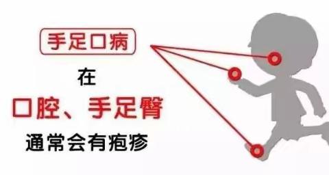 温馨提示：疱疹性咽峡炎进入高发期，比手足口病还厉害！