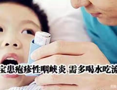 温馨提示：疱疹性咽峡炎进入高发期，比手足口病还厉害！（转给家长）