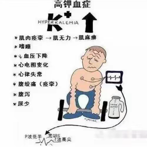高钾血症有多危险——你应该知晓！