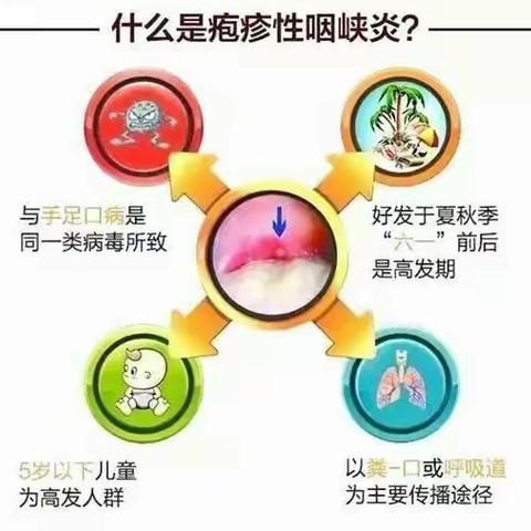 儿童疱疹性咽颊炎的症状和预防方法