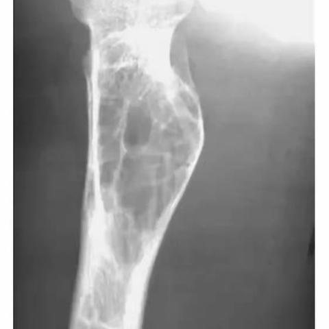 院外及文献资料骨科影像学资料【一】掌握这156种骨病，从此骨系统诊断不用愁