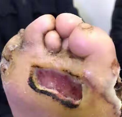 【二】未曾见、少见、和特殊及有问题病例随记——接上【一】