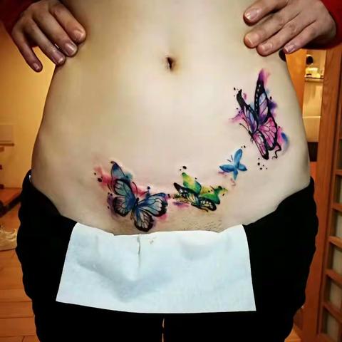 遮盖难看的剖腹产伤疤，来看看无锡纹身店脑洞大开的纹身作品