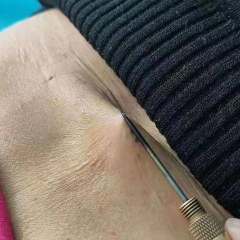 河西社区卫生服务中心开展颈椎，腰椎专项治疗。