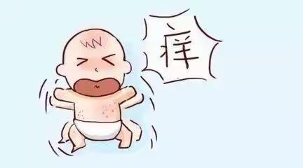 宝宝湿疹的防治