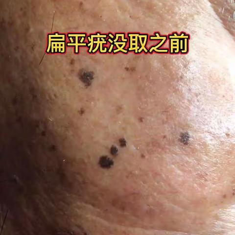 感谢叔叔的信任！