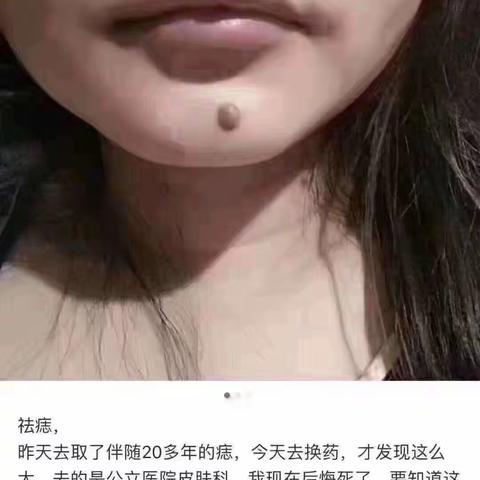 医院祛痣和痣尚馆的区别