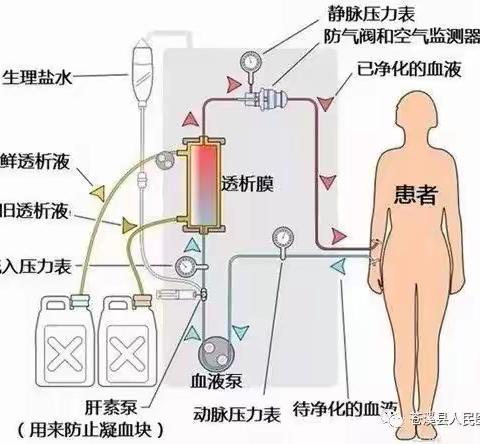 推行高质量透析，提升肾友生活质量