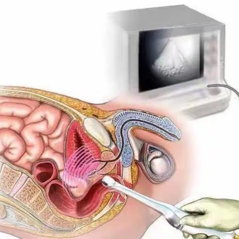 关爱男性健康——驻马店市中医院外三科关于前列腺癌的诊治经验分享