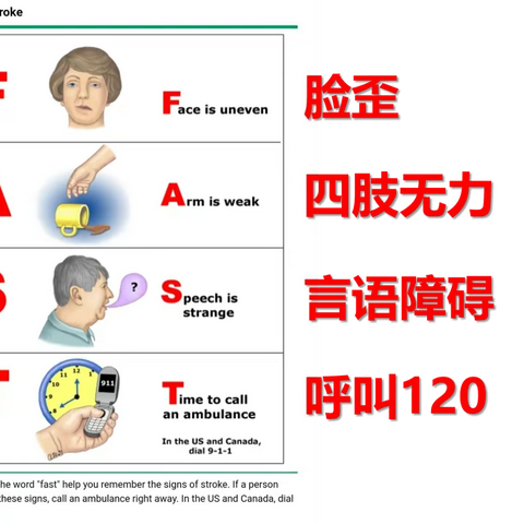 卒中120识别