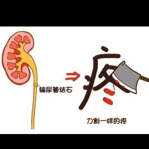 小小结石导致的生命之危