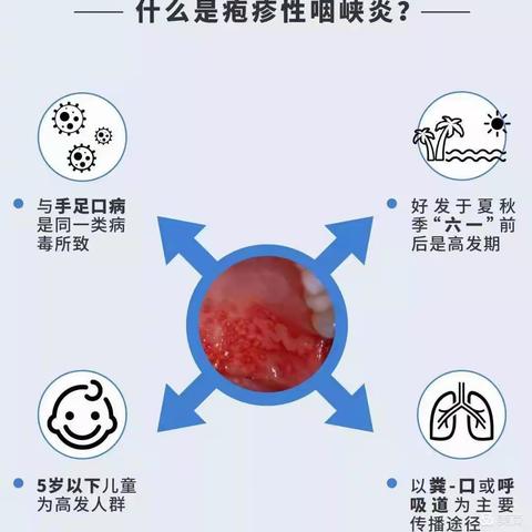 关注幼儿健康，预防疱疹性咽颊炎