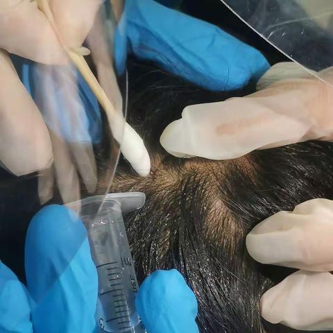 小“黑点”  大“危险”