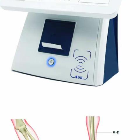 宣化区人民医院引进骨密度仪   助您早期发现骨质疏松