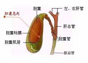 胆囊息肉你知道多少？