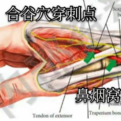 【新理念＋新路径】远桡动脉穿刺完成肝肿瘤介入栓塞＋同期结肠支架植入！只为老人获益。