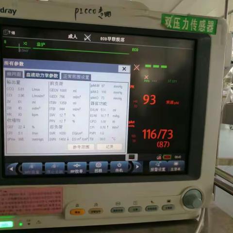 ICU首例急性双肺动脉栓塞阿替普酶静脉溶栓成功