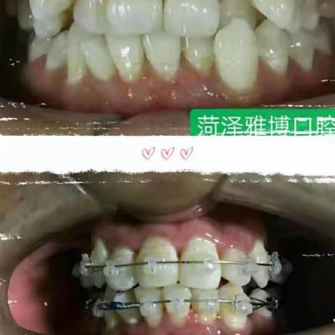 菏泽看牙哪家牙科医院好？排名前十的这三家收费价格曝光