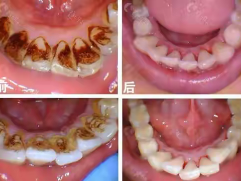 江苏连云港看牙好的牙科医院排名，种植牙、牙齿矫正价格便宜的是哪家