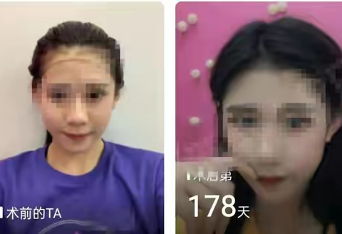 武汉哪家医院植发技术好？新生毛发种植效果怎么样？