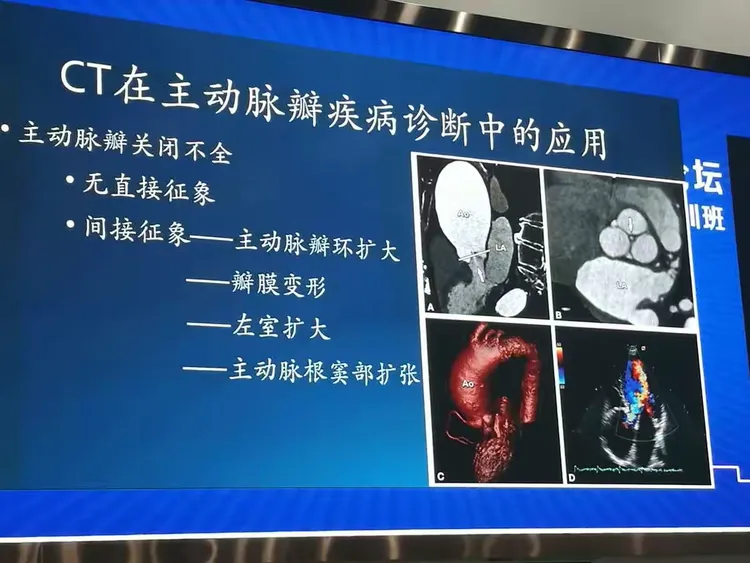 阜外医院预约专家CT加急-阜外医院ct报告一般几天出来 