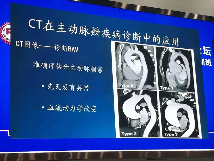 阜外醫院科室預約CT加急-阜外醫院ct報告一般幾天出來 