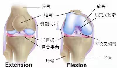 【干货】膝关节疼痛大总结，值得收藏