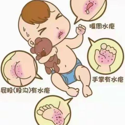 科学预防，健康同行——鼎立幼儿园秋季传染病预防知识