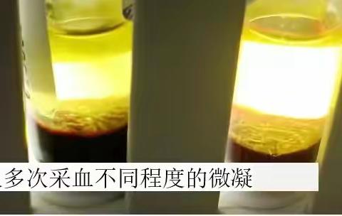 周学习-凝血标本（凝集判断小窍门）