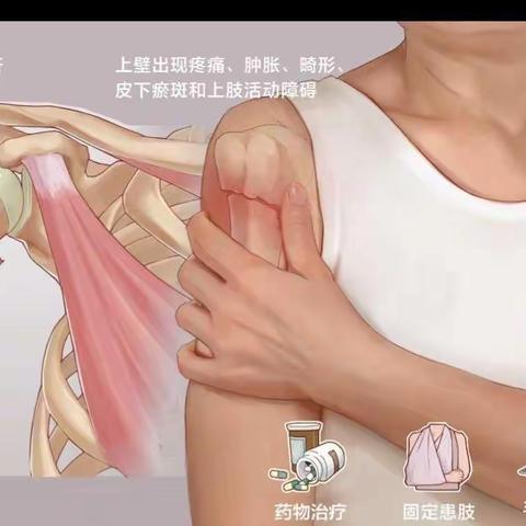 肱骨骨折