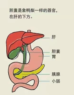 胆囊结石