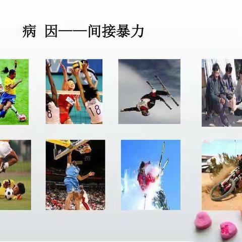 胫腓骨骨折