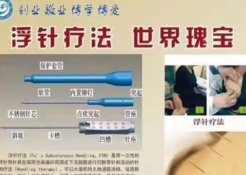 小针大用——建华区中医院（中铧街道社区卫生服务中心）开展浮针疗法