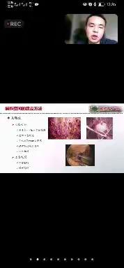 腔镜乳腺手术（唐鹏）