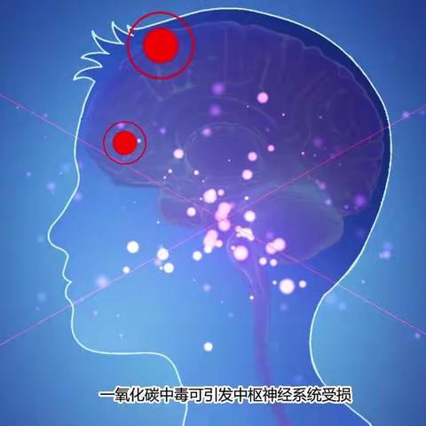 一氧化碳中毒视频共享