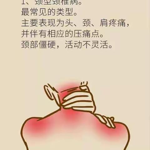颈椎病的分型和一套简便的颈椎操