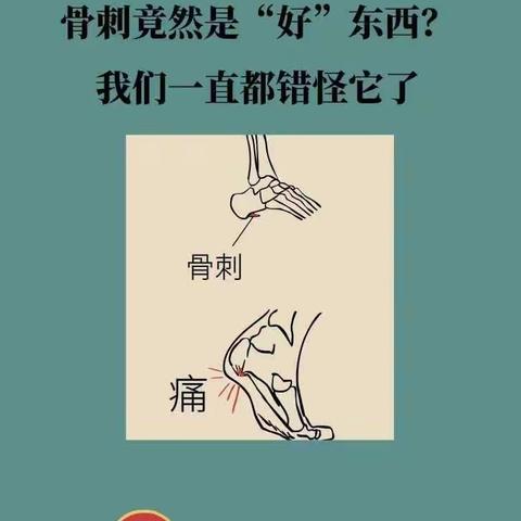 骨刺竟然是“好”东西？我们一直都错怪它了