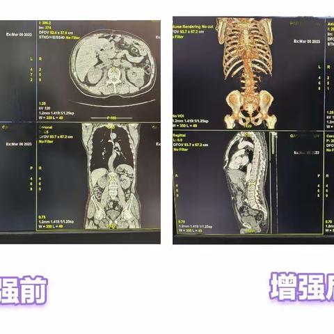 章丘逸乐医院开展CT增强检查，诊断再上新台阶