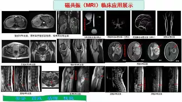 关于北京肿瘤医院挂号核磁(MRI)到底有什么区别?的信息
